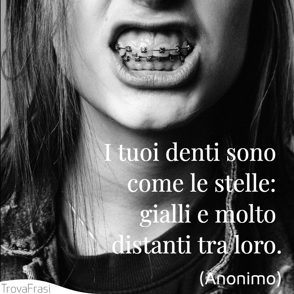 I tuoi denti sono come le stelle: gialli e molto distanti tra loro.