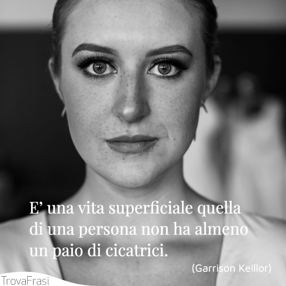 E’ una vita superficiale quella di una persona non ha almeno un paio di cicatrici.